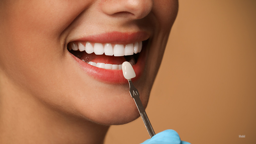 woman's teeth color on closeup